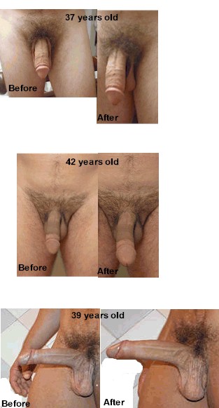 Age Of Penis Growth 17