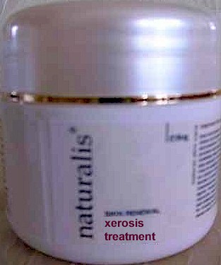 Xerosis Treatment